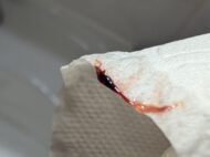 {{brizy_dc_image_alt entityId=