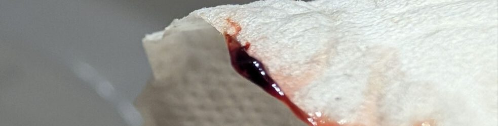 {{brizy_dc_image_alt entityId=